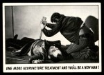 #38 One more acupuncture treatment  