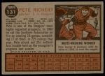 1962 Topps #131 NRM Pete Richert<br />B62T 12 4407<br /><a class='button AddToCart' data-ajax='true' data-ajax-mode='replace' data-ajax-update='#cart-info' href='/AddToCart?itemId=7030556&quantity=1&type=0'>Add To Cart</a>