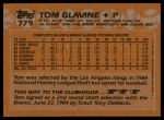 1988 Topps #779 Tom Glavine<br />ST01 06 8562<br /><a class='button AddToCart' data-ajax='true' data-ajax-mode='replace' data-ajax-update='#cart-info' href='/AddToCart?itemId=7074881&quantity=1&type=0'>Add To Cart</a>